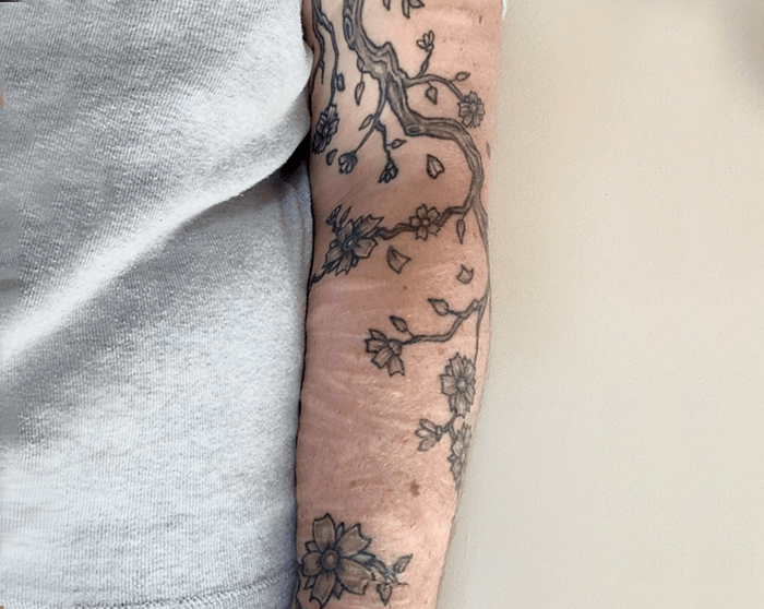 [Eliza B. is a woman in her early 20s, and has tattoos of branches and flowers on her arm covering scars.]